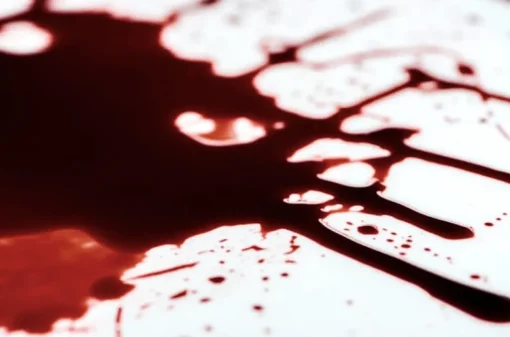 ForensicFX Studios Dark Aged Blood Flash Sale