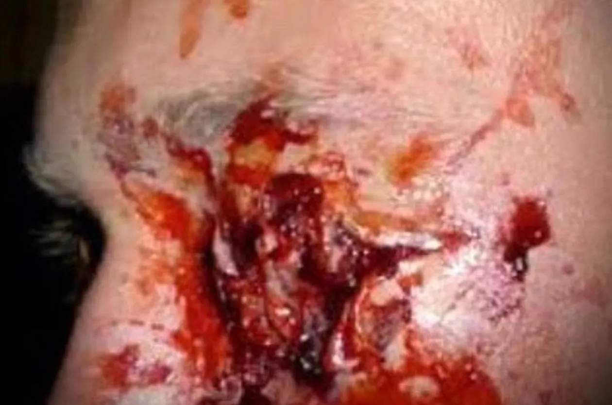 ForensicFX Studios Deep Gauged Out Eye Prosthetic Clearance