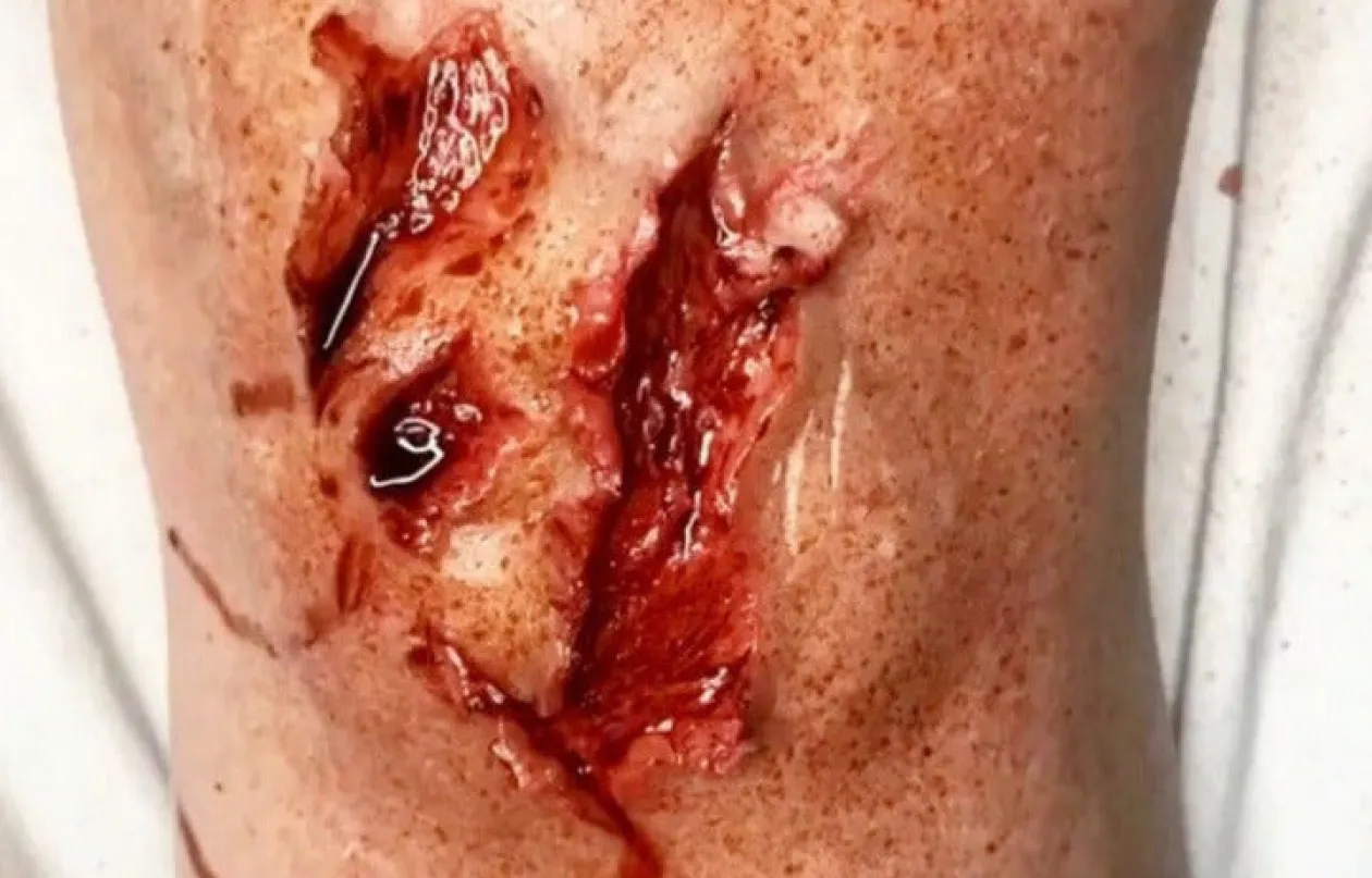 ForensicFX Studios Deep Opened Mangled Wounds Prosthetic Cheap