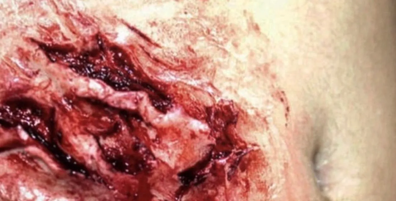 ForensicFX Studios Deep Opened Mangled Wounds Prosthetic Cheap