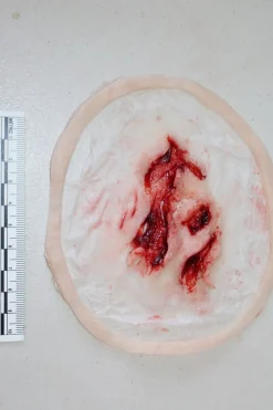 ForensicFX Studios Deep Opened Mangled Wounds Prosthetic Cheap