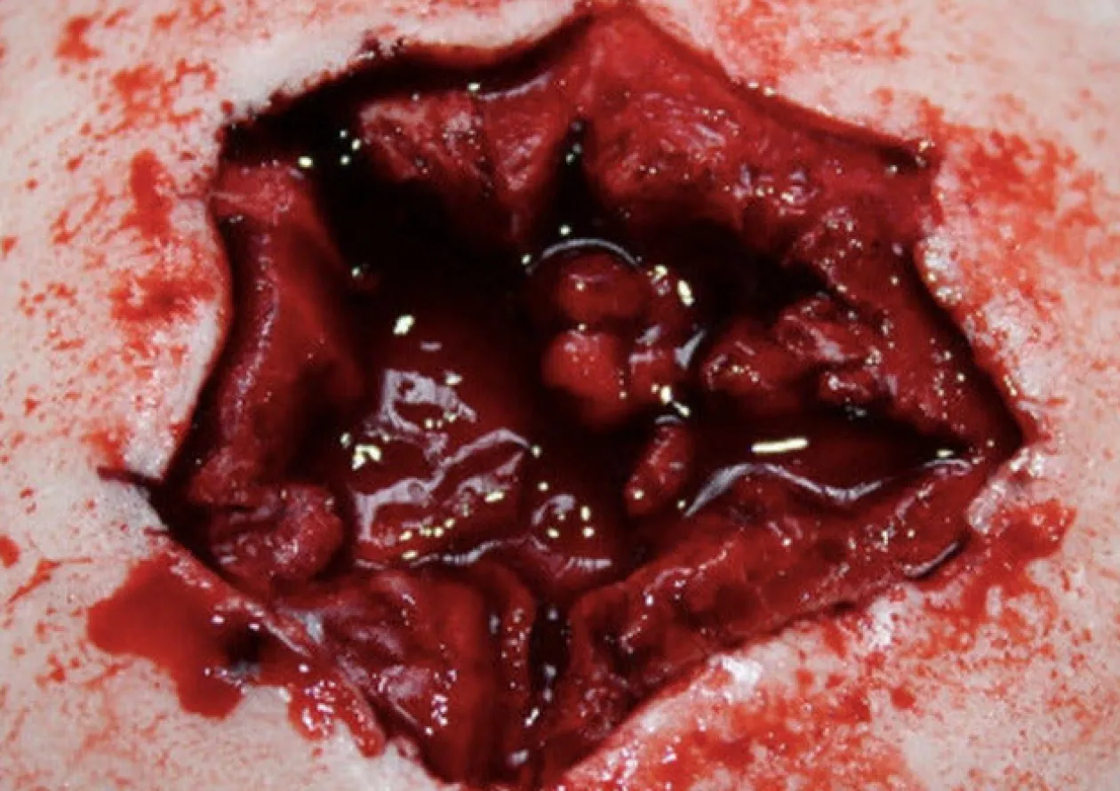 ForensicFX Studios Exit Bullet Wound Prosthetic New