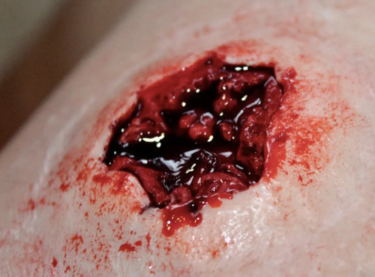 ForensicFX Studios Exit Bullet Wound Prosthetic New