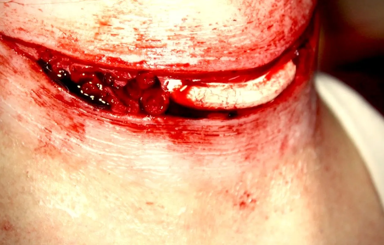 ForensicFX Studios Exposed Slit Throat Prosthetic Fashion