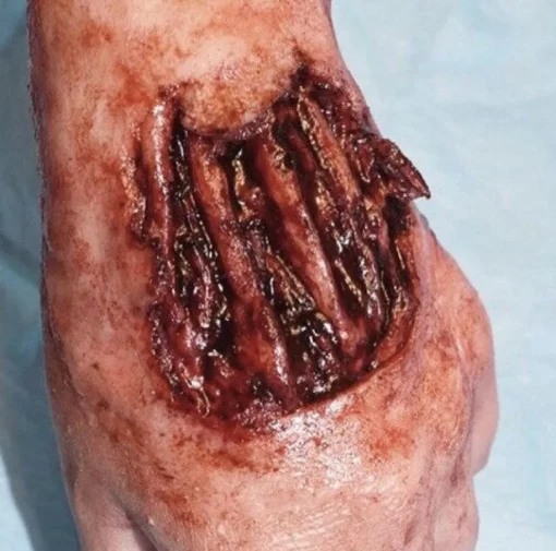 ForensicFX Studios Gorey Prosthetics Bundle Discount