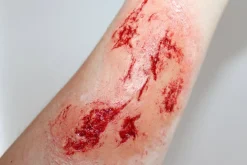 ForensicFX Studios Irregular Wound Lacerations Prosthetic Best Sale