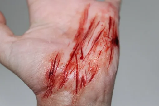 ForensicFX Studios Knife/Stab Wound Prosthetic Bundle Outlet
