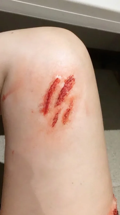 ForensicFX Studios Medium Scratch Mark Wounds Prosthetic Shop