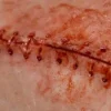 ForensicFX Studios Opened Stitches Prosthetic Store