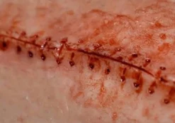 ForensicFX Studios Simple Prosthetics Bundle Shop