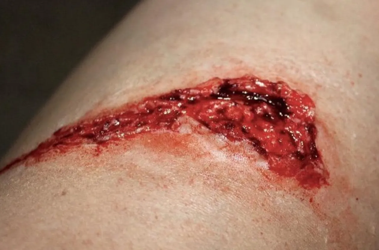 ForensicFX Studios Simple Prosthetics Bundle Shop