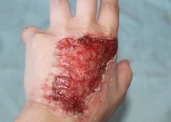 ForensicFX Studios Skin Burn Prosthetic Online