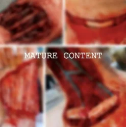 ForensicFX Studios Skinned Alive Prosthetic Bundle Discount