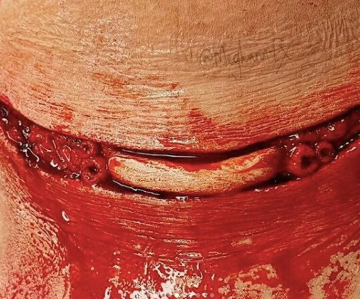 ForensicFX Studios Skinned Alive Prosthetic Bundle Discount