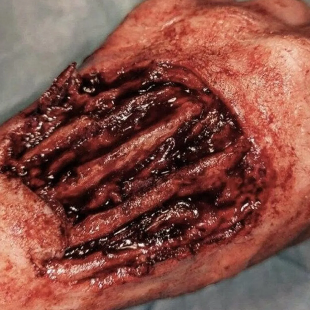 ForensicFX Studios Skinned Alive Prosthetic Bundle Discount