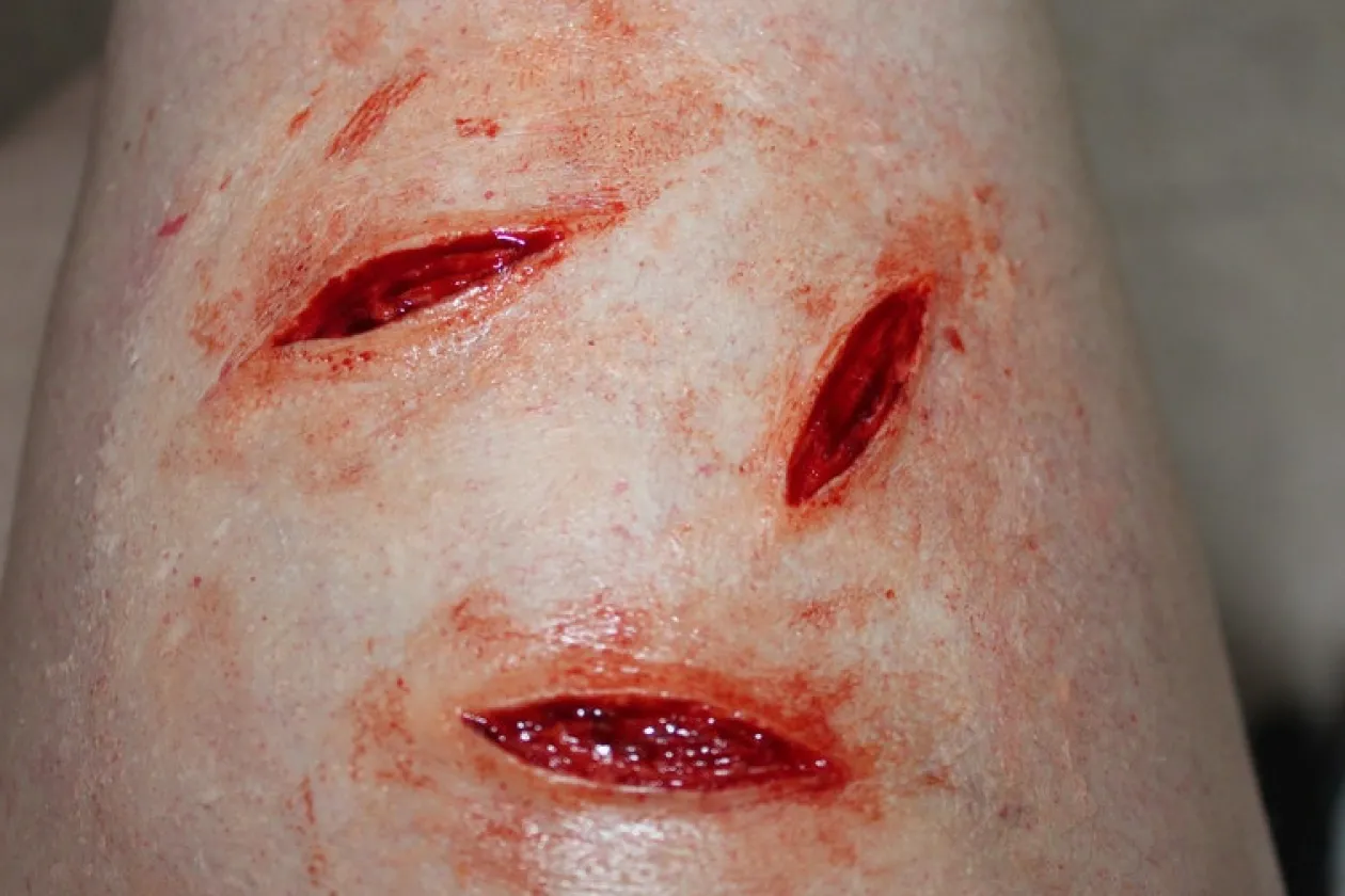 ForensicFX Studios Small Shallow Knife Stab Wounds (X3) Prosthetic Outlet