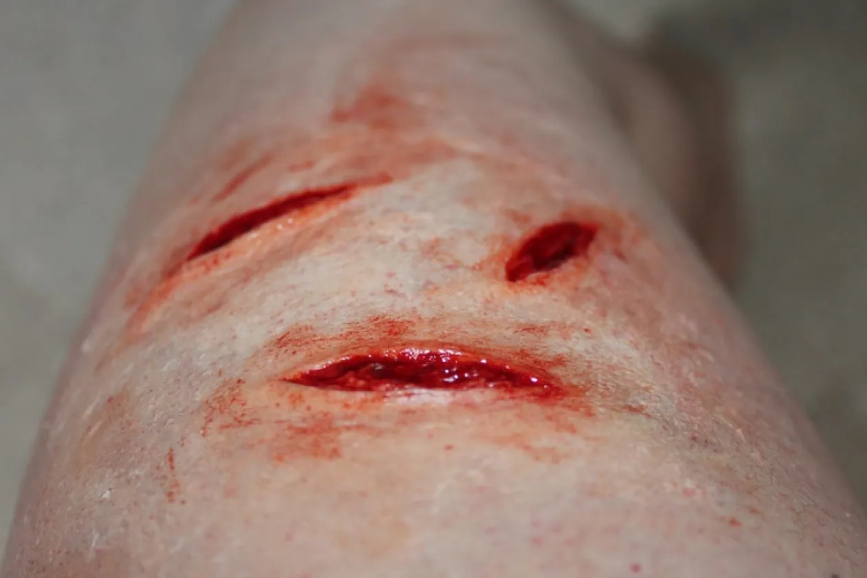 ForensicFX Studios Small Shallow Knife Stab Wounds (X3) Prosthetic Outlet