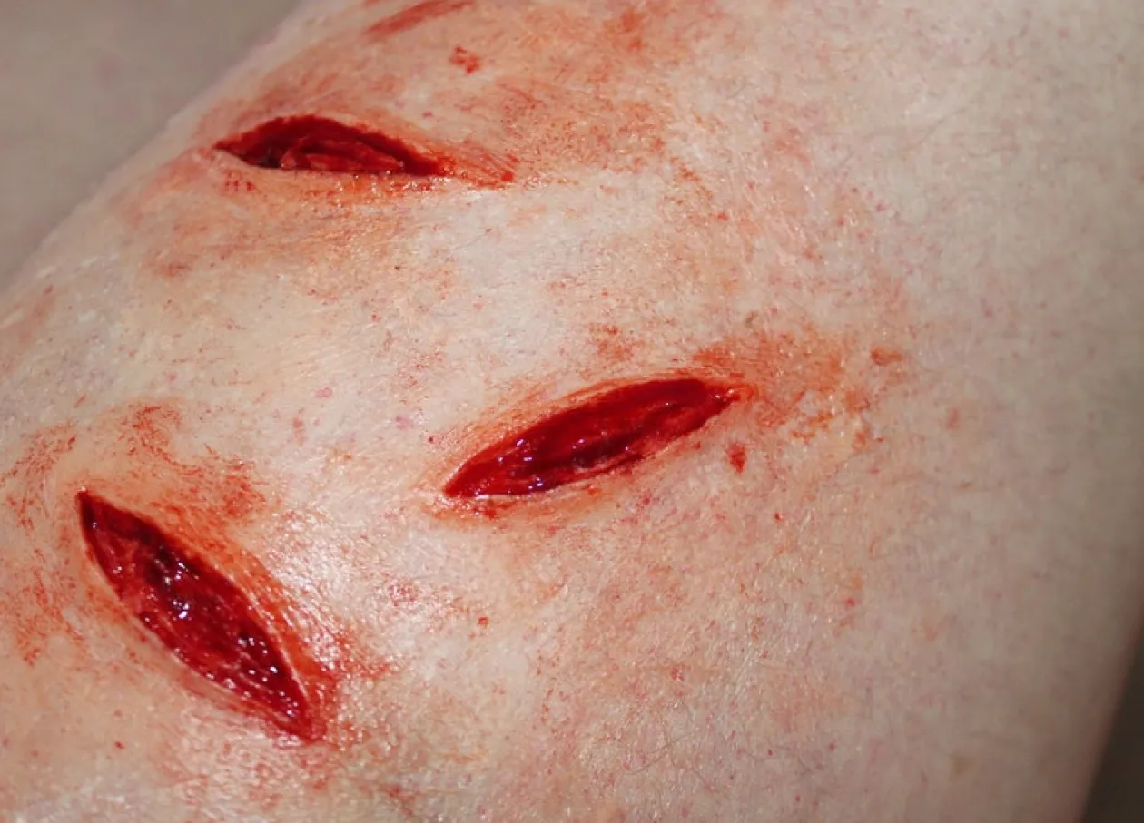 ForensicFX Studios Small Shallow Knife Stab Wounds (X3) Prosthetic Outlet