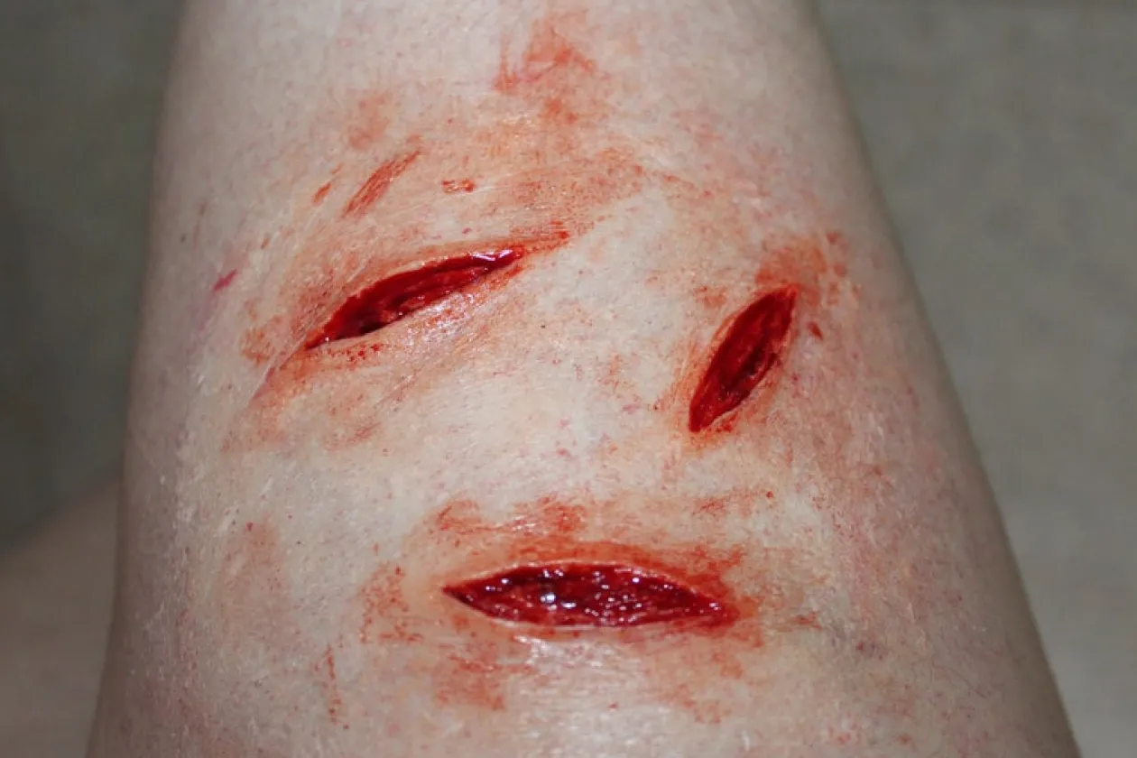 ForensicFX Studios Small Shallow Knife Stab Wounds (X3) Prosthetic Outlet