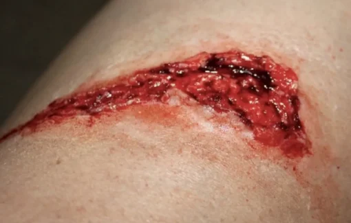 ForensicFX Studios Small Thigh Laceration Prosthetic Discount