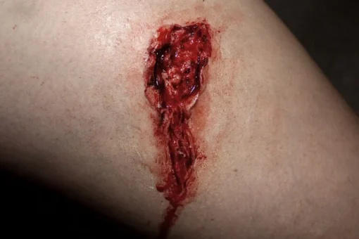 ForensicFX Studios Small Thigh Laceration Prosthetic Discount