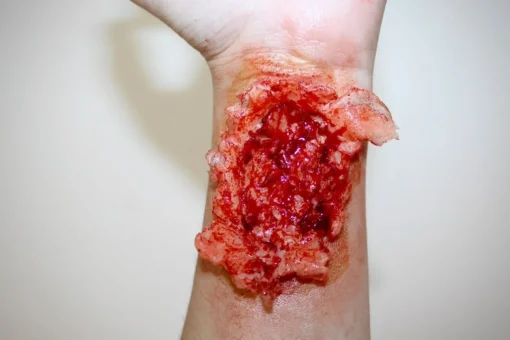 ForensicFX Studios Torn Wrist Prosthetic Flash Sale